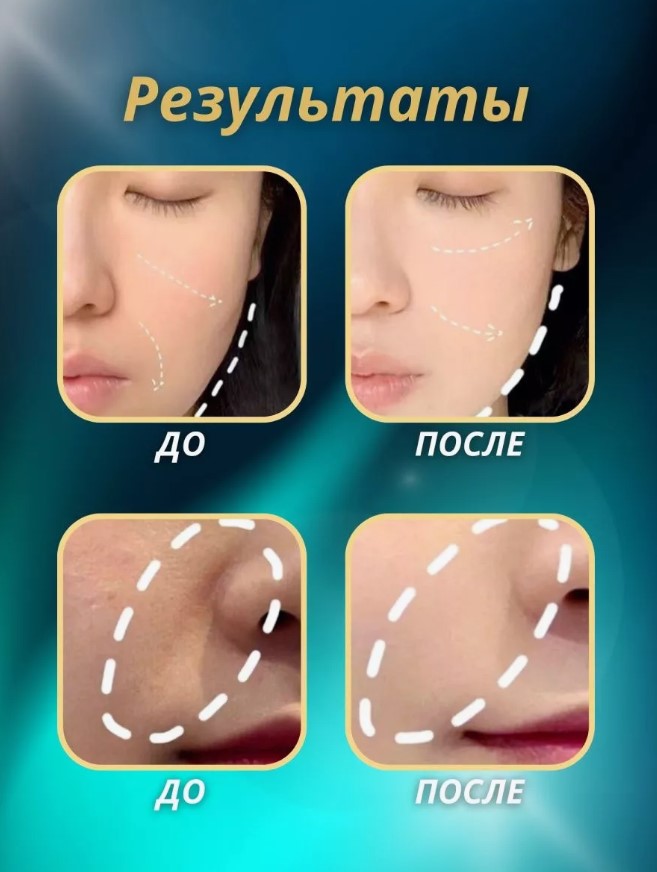 3D Электромассажер для лица